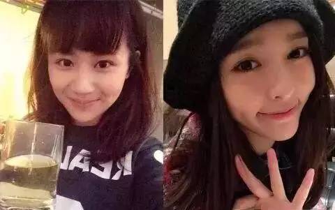 烂演技不可怕整容脸才尴尬,盘点影视剧的整容脸