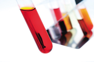 血脂化验单上脂蛋白a是什么,教你看明白自己的血脂化验单