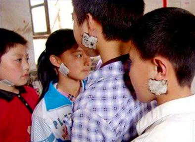 孩子得了腮腺炎能够吃鸡蛋吗,儿童腮腺炎会感染大人吗