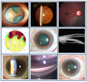 二十种眼型图解阴阳眼,青光眼能做九宫格眼底照相吗