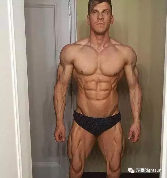 健美冠军体脂率是多少,26岁健美冠军小腿静脉爆裂