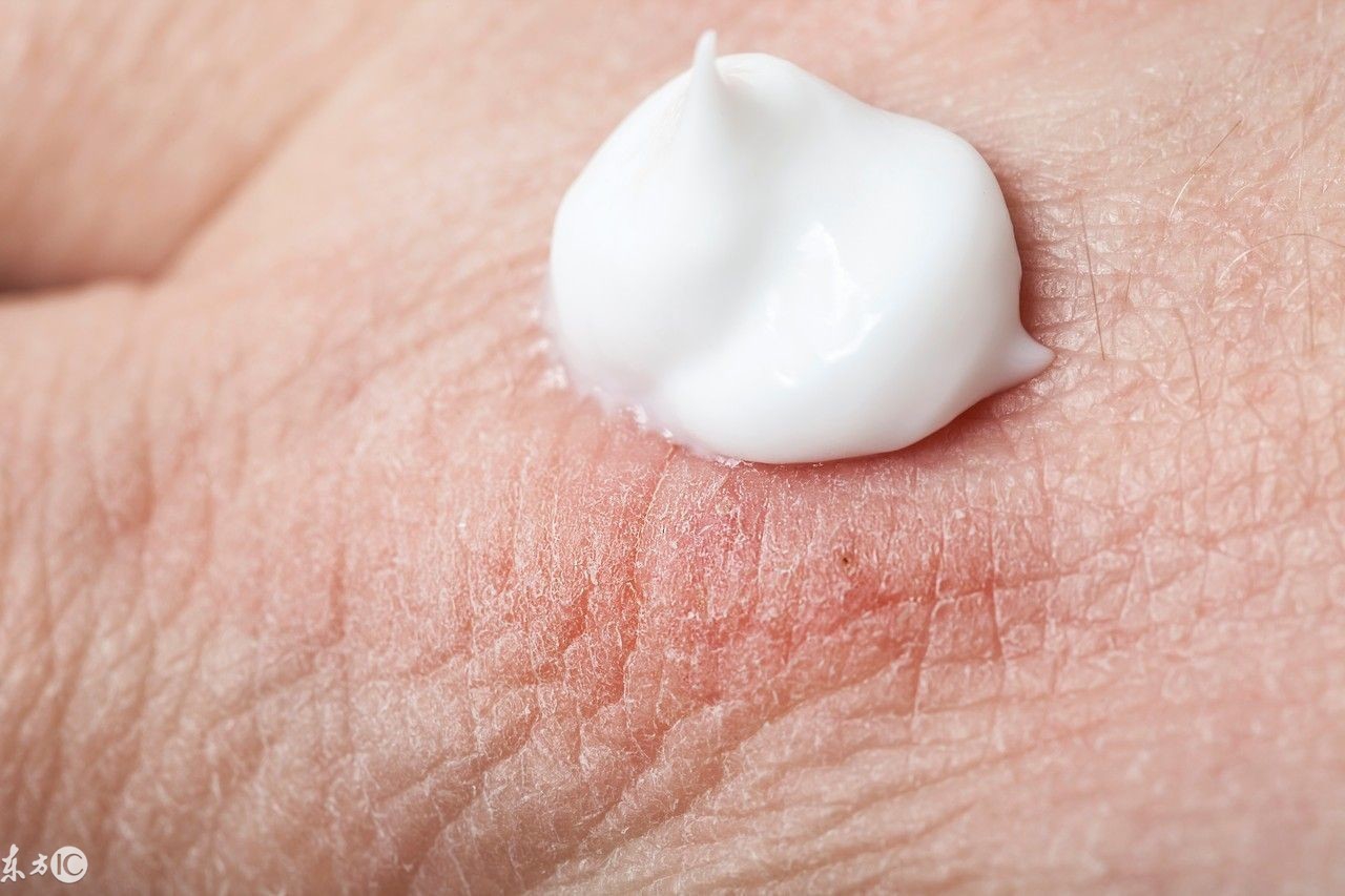 官方澳洲正宗绵羊油,澳洲代购绵羊油怎么样