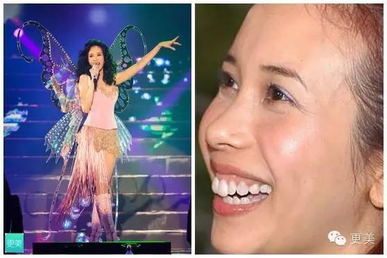 当青春变成了鱼尾纹,青春鱼尾纹