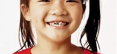 儿童矫正牙齿打骨钉的危害有哪些,一般情况下矫正牙齿效果有何差别