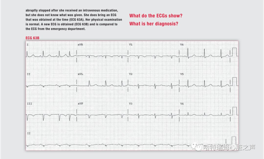 「读心有术」329期：电轴极度左偏，病因有两种