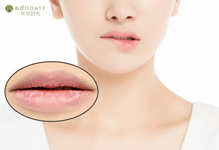 孕期嘴唇干裂怎么办用什么唇膏,孕期嘴唇脱皮干裂怎么回事