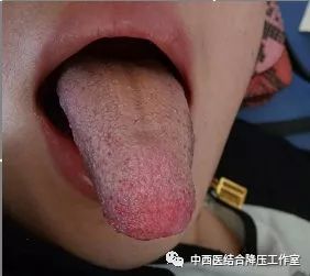 治感冒发烧用的方子用到哪味中药,治风寒感冒发烧咳嗽绝密偏方