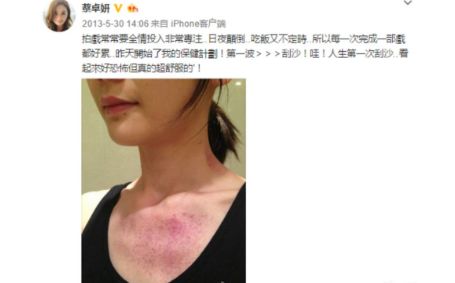 闃垮▏鏅掑埉鐥ф不鐤楃収,闃垮▏鑴搁儴鍒棫