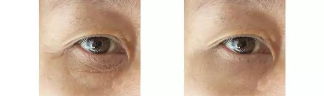 如何判断自己的眼睛的年龄,听说从一个人的眼睛能够看出年龄