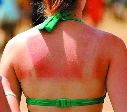 晒黑后能够变得比原来更白吗,晒黑后皮肤如何白回来教你小方法