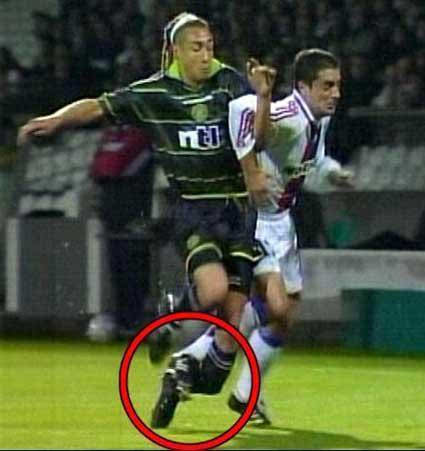足球史上10大最严重的断腿视频,挥不去的梦魇结局