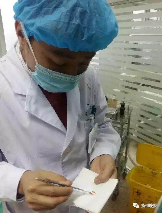 长出两排牙齿,6岁女童下排有11颗牙齿