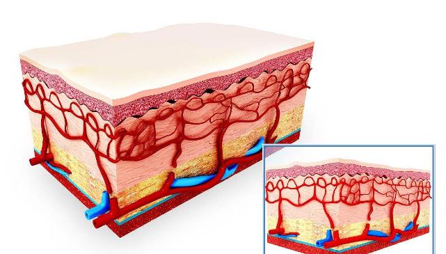 一个自然祛扁平疣的最好方法,有什么小妙招能够去除扁平疣
