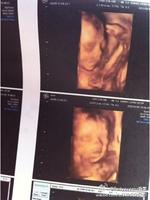 怎么才能知道肚子里的孩子是男女,多久能够知道肚子里孩子是男女