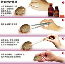 采野菜踏青，“虫子”钻进了她的太阳穴！