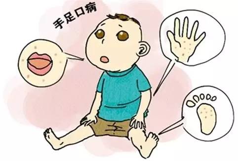 宝妈们注意手足口病防控知识,手足口病防治指南宝妈赶紧学起来