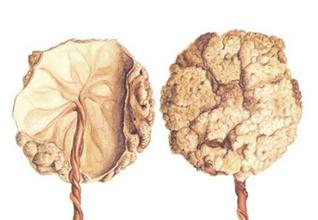 生完孩子后胎盘能够吃吗,生了孩子后胎盘能够吃吗