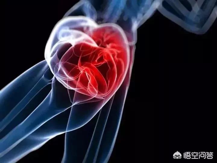 伤筋动骨100天吃药吗,伤筋动骨100天是必须躺100天吗