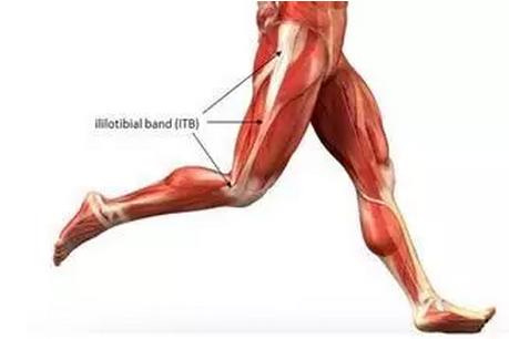 髂胫束综合征是哪里疼,髂胫束疼能够用筋膜枪吗