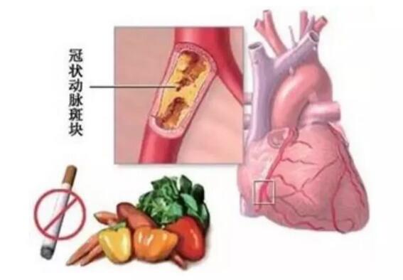 安钢总医院名医系列推送活动之——心血管内科行家李东旺