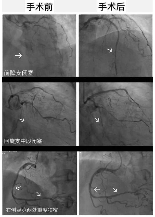 安钢总医院名医系列推送活动之——心血管内科行家李东旺