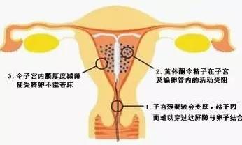 什么样的女性不合适上环,单身女性上环是什么心态