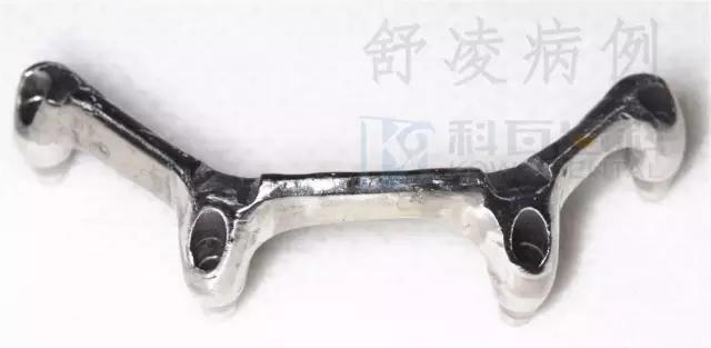 活动假牙戴不住，种植牙又嫌贵该怎么办？