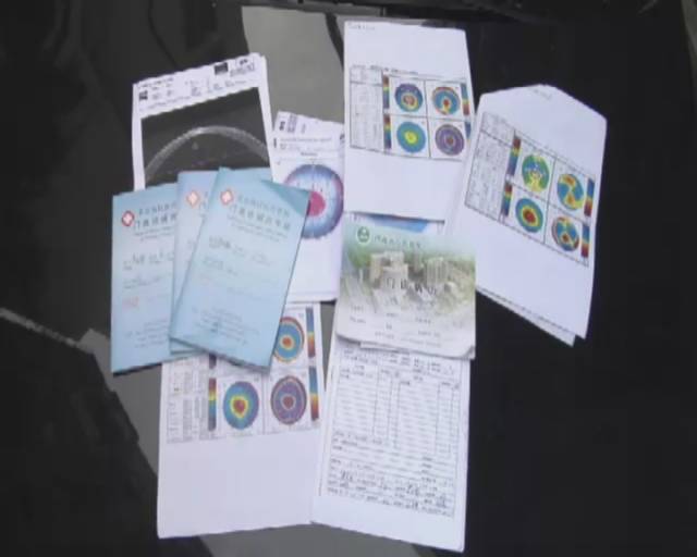 记者体验治疗近视,治疗近视的真实案例