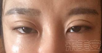 嘿医生直播,嘿医生