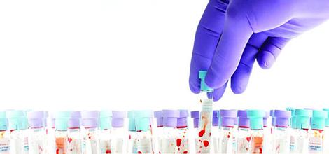 上海哪里买的到国产的人血白蛋白,进口的人血白蛋白便宜