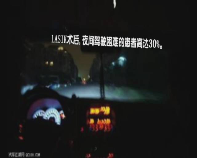 记者体验治疗近视,治疗近视的真实案例