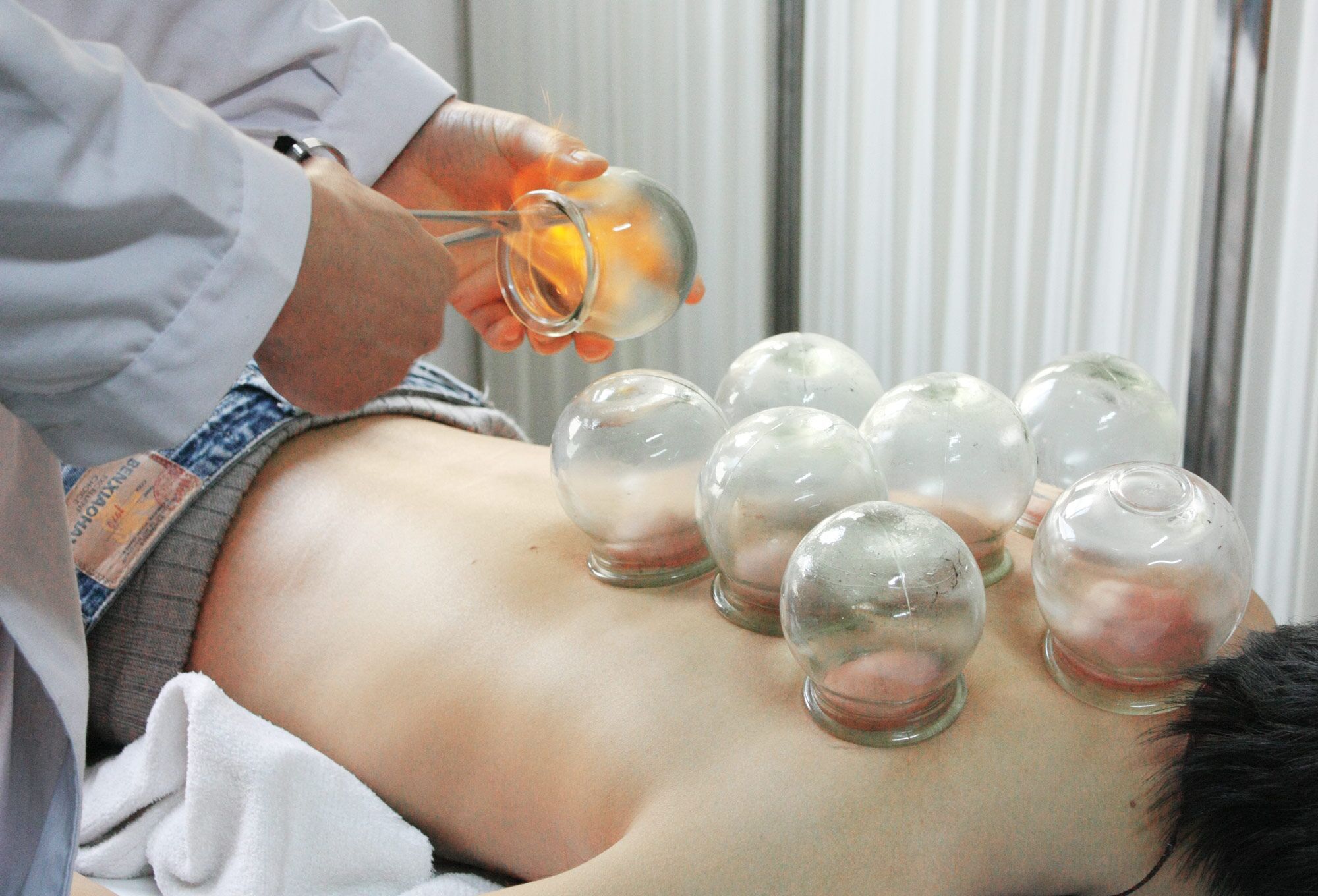 体内湿气太重拔罐是紫黑色,放血拔罐对湿气太重有用吗