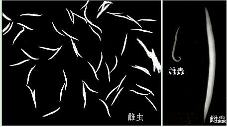 孩子面色发黄消瘦不长个,小孩面色发黄消瘦吃哪种药物调理