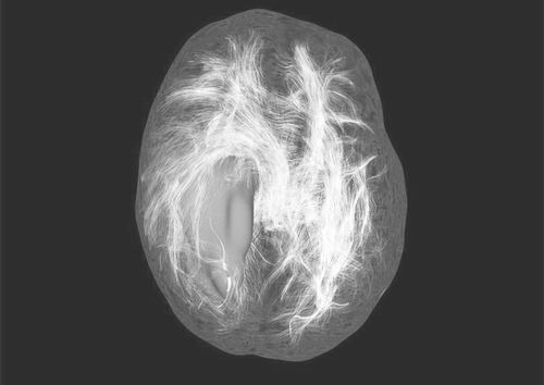 美药企抗癌新药,美企收购阿尔斯通