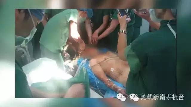 济南男子被1米长钢筋从阴部穿到脑部30名行家开颅开胸开腹手术7小时保住命