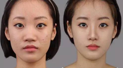 站在鼻整形塔尖的男人——亚洲鼻王曾高加盟*疆新**华美