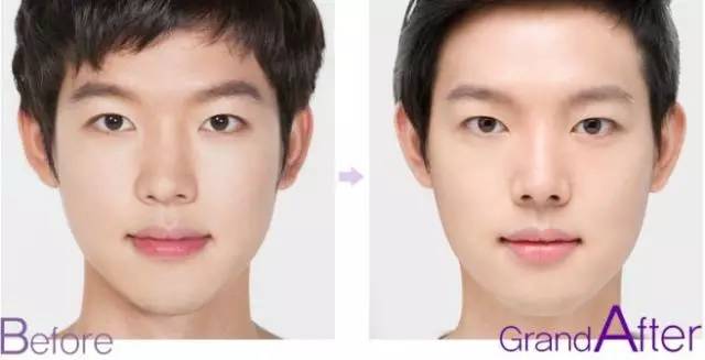 站在鼻整形塔尖的男人——亚洲鼻王曾高加盟*疆新**华美