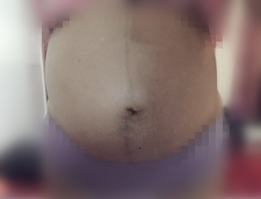 做四维医生说宝宝胎动幅度不大,四维胎动频繁和不怎么活泼对比