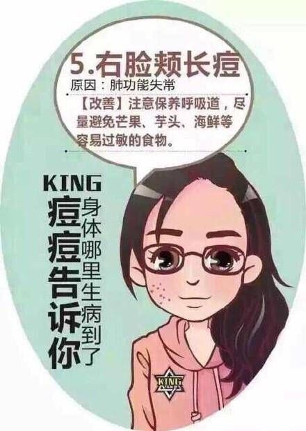 脸上痘痘分布说明身体什么问题,行家讲解痘痘经验