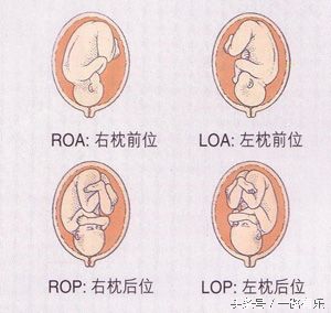 分娩过程中最常见的胎位,分娩中最常见胎位