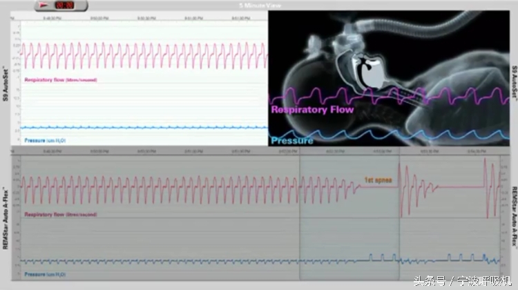 瑞思迈s9autoset-s的价格,瑞思迈s9autoset-s评测