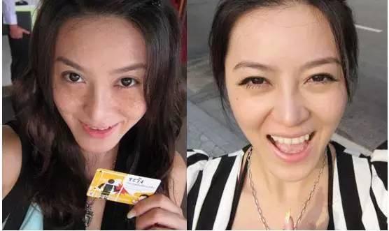 祛斑小妙招快速祛斑,青春期淡斑祛斑小妙招