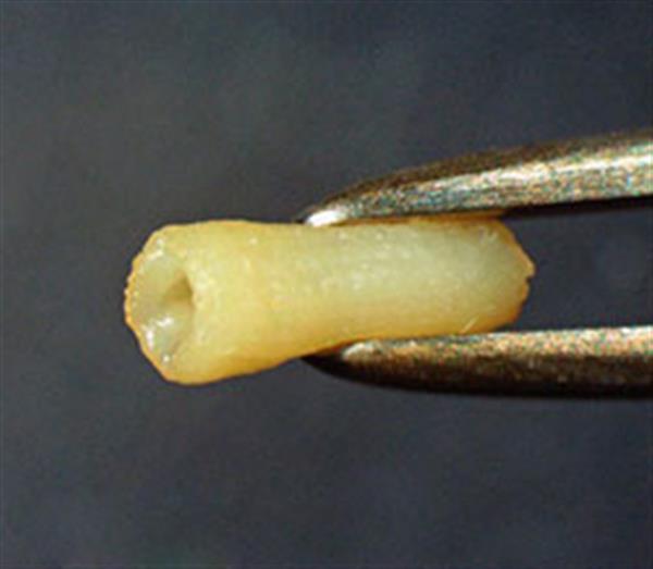 3d血管打印机,日本医学3d打印手指