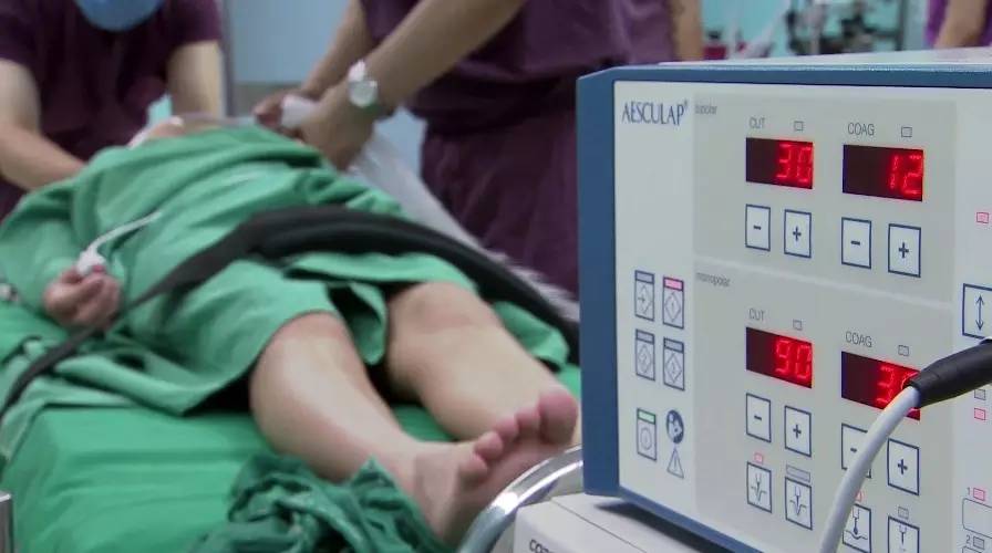 神经外科癫痫手术能根治吗,神经外科大夫治疗癫痫的方法