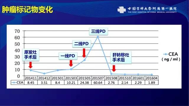 肠癌肝转移同时性和异时性,邢宝才治疗肠癌肝转移告捷病例