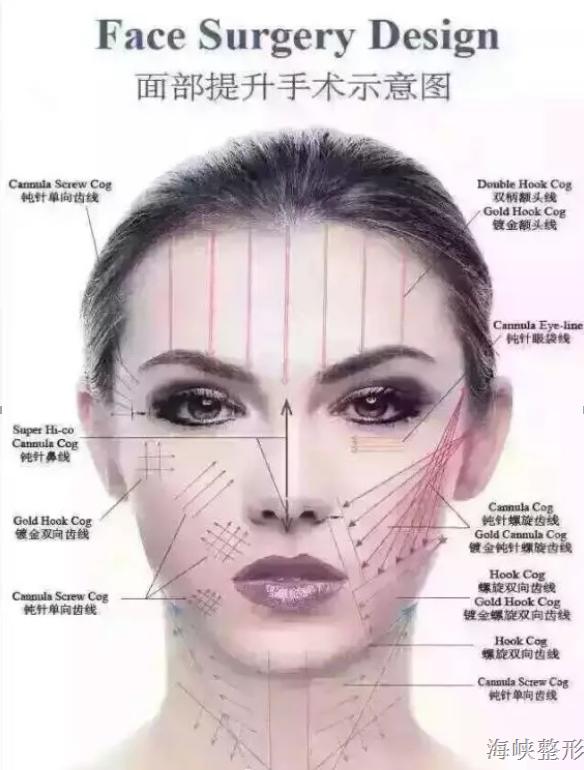 注射微整形需要了解哪些知识呢,注射美容和微整形有什么区别