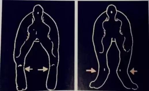 怎样挑选一只好的雪纳瑞犬,如何挑选一只合适家养的雪纳瑞