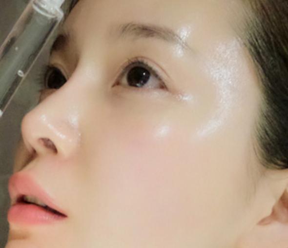 长斑要补水出现的皱纹怎么办,油性皮肤是不是不容易长斑长皱纹