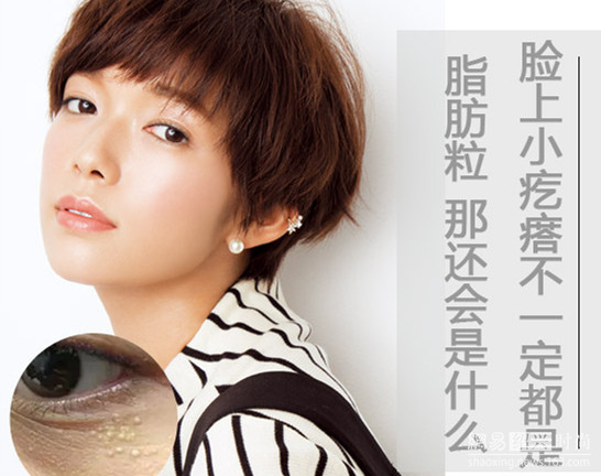 眼睛周围长出的这些小米粒儿，到底是什么呢？