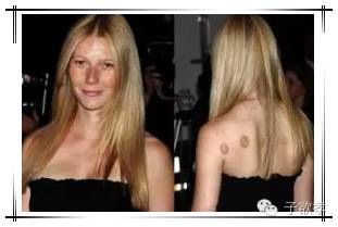 里约奥运会拔火罐,奥运会纹身